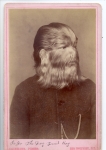 Jo-Jo the 'Dog Faced Boy' (2) late 1800's.jpg